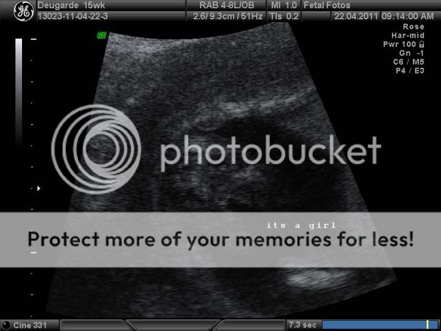 15 week 3d/4d ultrasound, how accurate in Your Pregnancy | Forum | Huggies